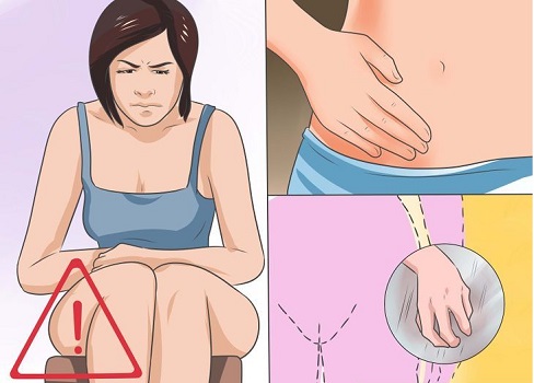Top 8 Home Remedies for Yeast Infection